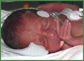 newborn baby with monitors attached